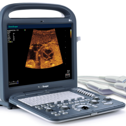 SONOSCAPE S2 ECOGRAFO DOS 2 CONECTORES PARA DOS 2 TRANSDUCTORES PANTALLA DE 15 PULGADAS ECOGRAFO PORTATIL SONOSCAPE S2
