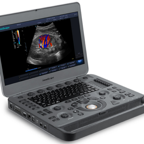 SONOSCAPE X3 ECOGRAFO MULTIHAZ ARMONICAS PROCESAMIENTO DE IMAGENES μ-Sca ECOGRAFO PORTATIL SONOSCAPE X3
